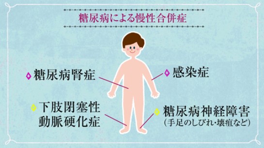糖尿病合併症 糖尿病合併症